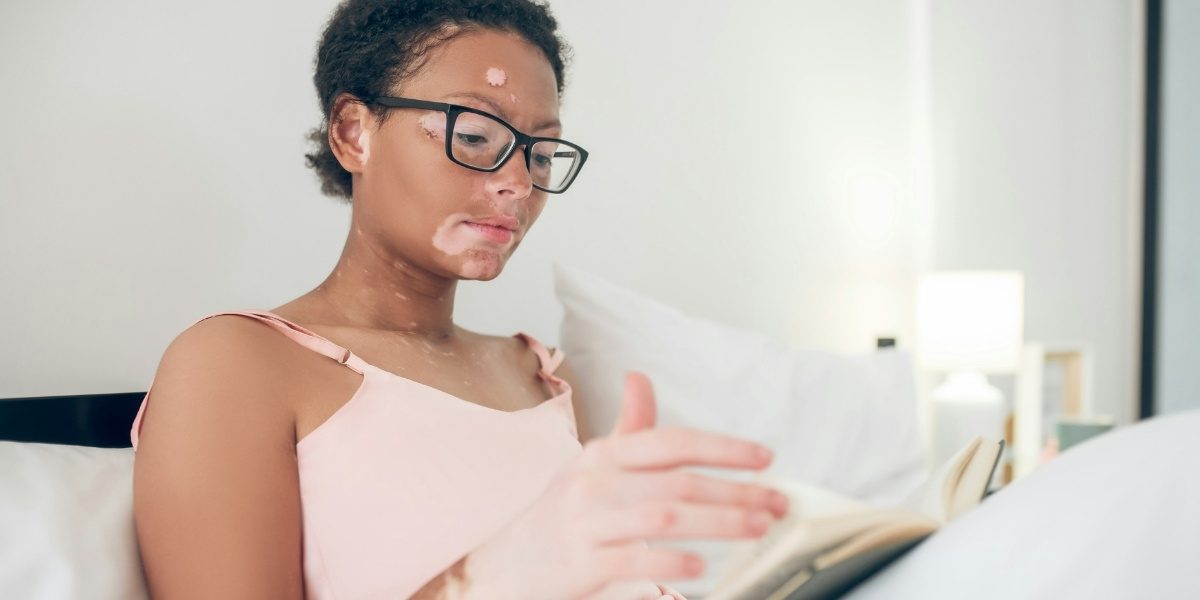 Holistic Approaches to Managing Vitiligo Effectively